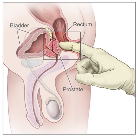 Male G Spot location