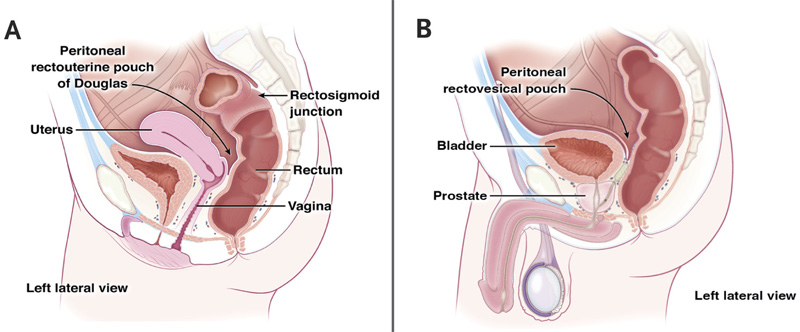 Rectal anatomy